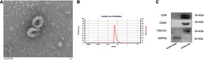 Comprehensive Analysis of Peripheral Exosomal circRNAs in Large Artery Atherosclerotic Stroke